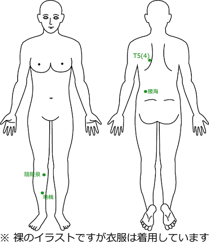 腰痛症･ぎっくり腰の症例21のツボの位置画像