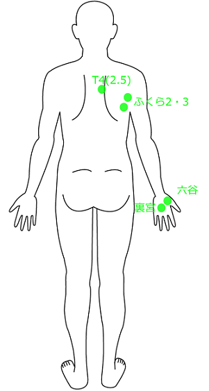 肘の痛みの症例3の使用したツボの位置画像